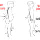 Posture and Low Back Pain