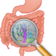Chronic Health Issues and Leaky Gut Syndrome
