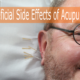 Beneficial Side Effects of Acupuncture Treatment