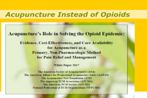 acupuncture instead of opioids