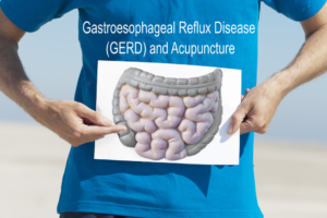 GERD and Acupuncture