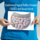 Gastroesophageal Reflux Disease (GERD) and Acupuncture